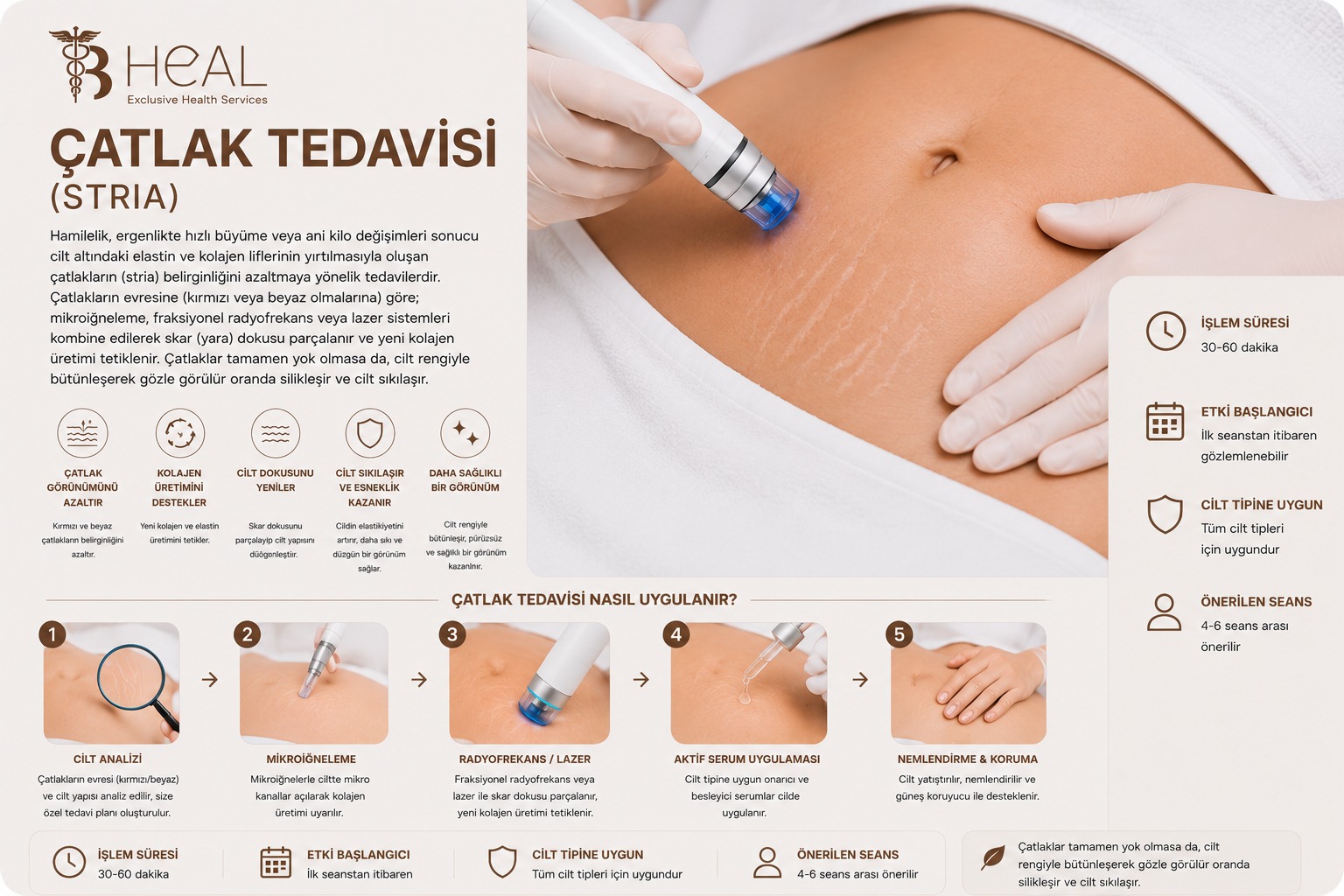 Çatlak Tedavisi (Stria)